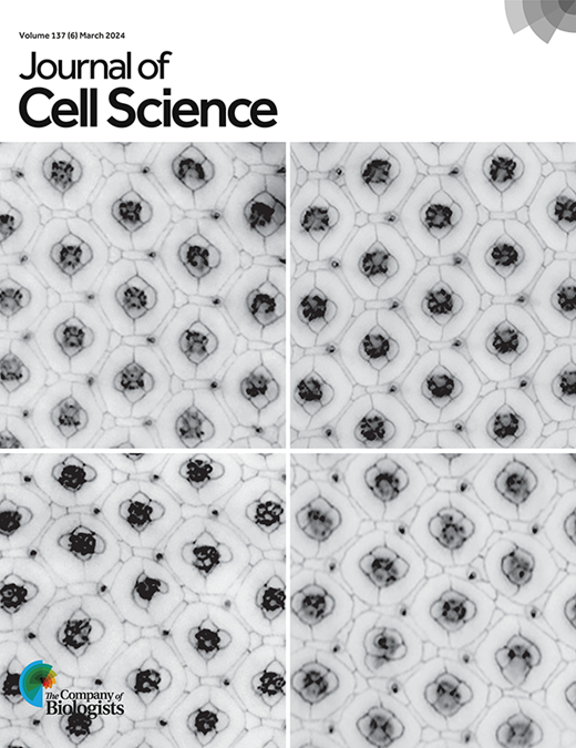 Endoplasmic reticulum stress impedes regulated secretion by governing ...
