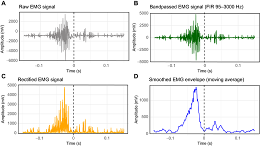 キツツキの掘削能力の生理学的仕組みを解明(Pecking with power: How tiny woodpeckers deliver devastating strikes to drill into wood) キツツキの掘削能力の生理学的仕組みを解明(Pecking with power: How tiny woodpeckers deliver devastating strikes to drill into wood)